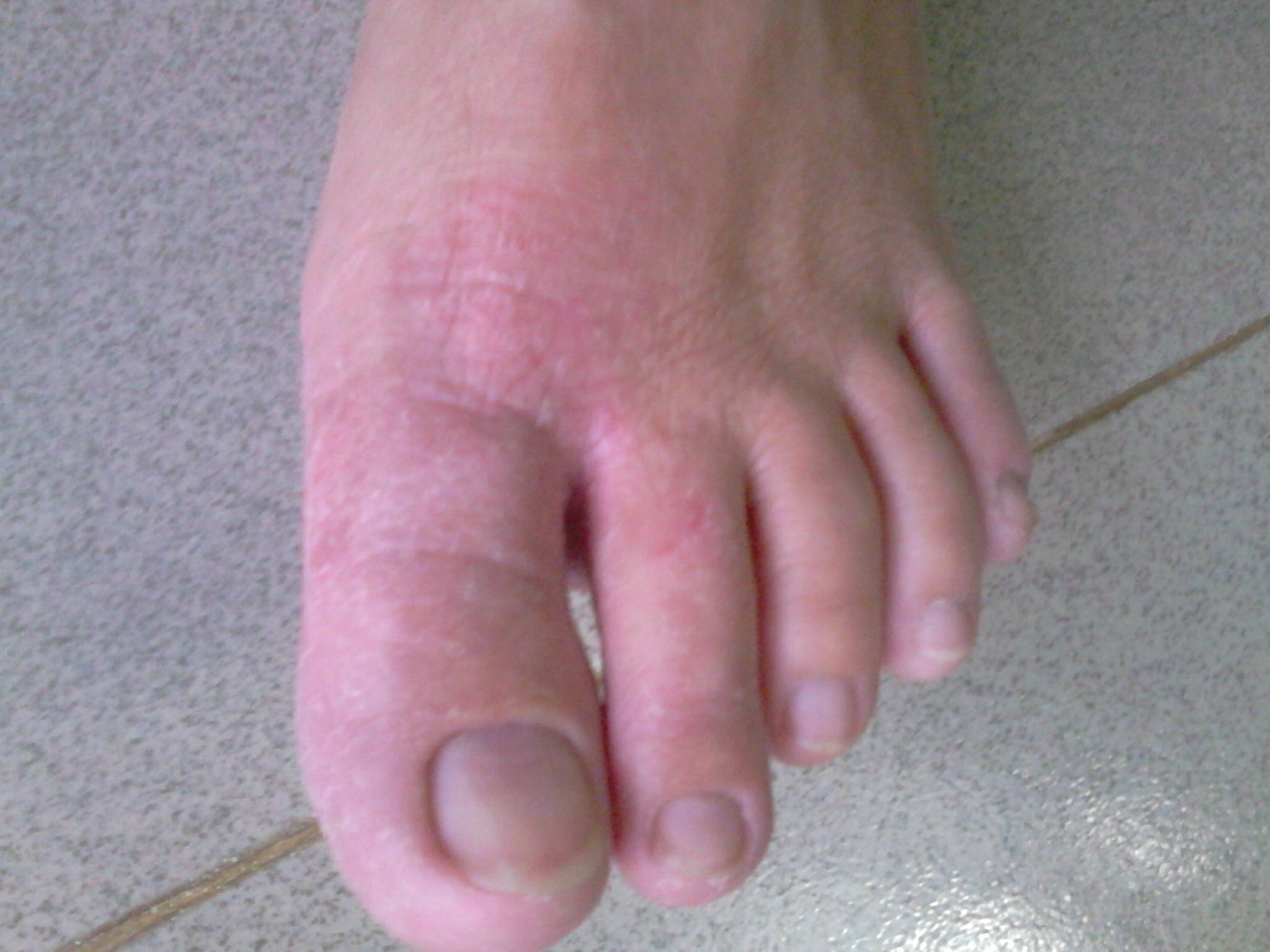 Thuốc gia truyền trị bệnh ngoài da Giá bán: 0đ