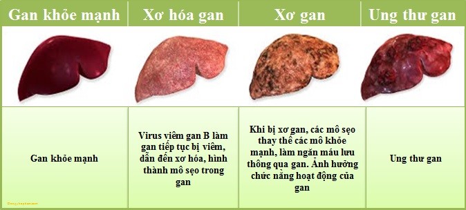 Thực phẩm chức năng Hoàng Mộc Lan Giá bán: 120.000đ