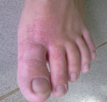 Thuốc gia truyền trị bệnh ngoài da