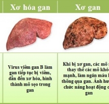 Thực phẩm chức năng Hoàng Mộc Lan